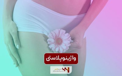 جراحی واژینوپلاستی روش موثر و ماندگار
