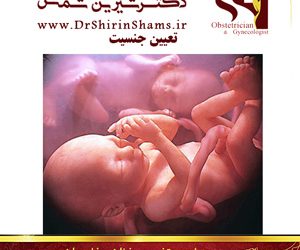 بهترین روش های تعیین جنسیت جنین