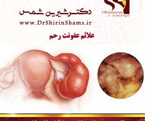 علائم عفونت رحم