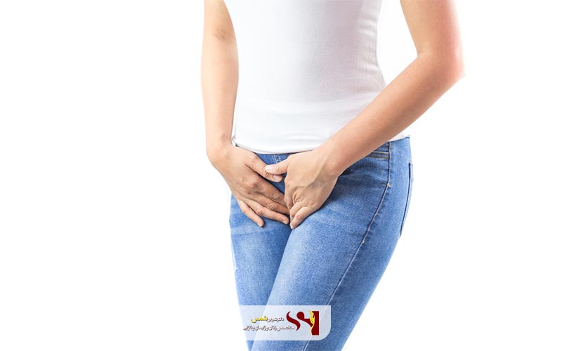 انواع نخ لیفت واژن با نخ