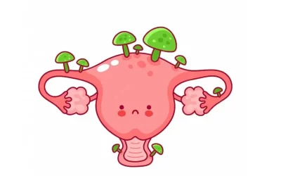 عفونت قارچی واژن