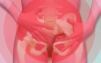 جراحی پرینورافی یا پرینوپلاستی