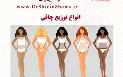 انواع توزیع چاقی