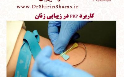کاربرد PRP در زیبایی زنان