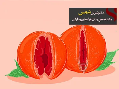 هزینه تنگ کردن واژن با لیزر