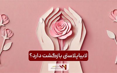 آیا لابیاپلاستی بازگشت دارد؟