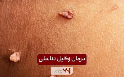 درمان زگیل تناسلی؛ 5 روش قطعی و موثر