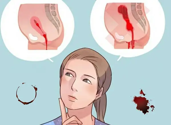 علائم خونریزی غیر طبیعی قاعدگی