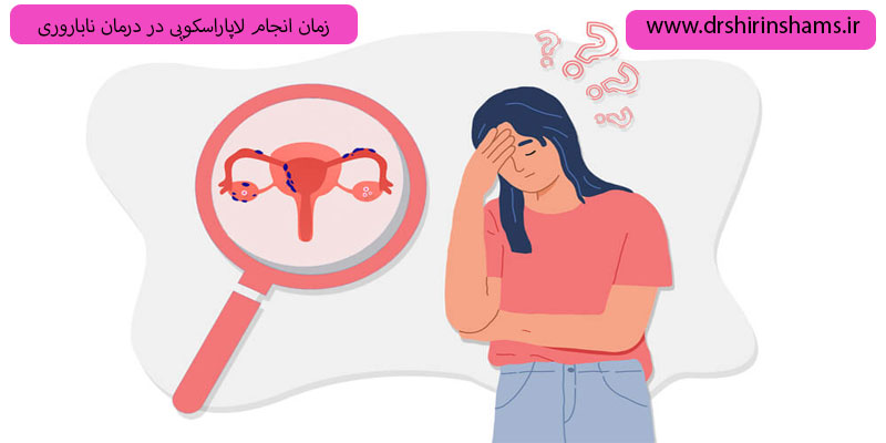 زمان-انجام-لاپاراسکوپی-در-درمان-ناباروری