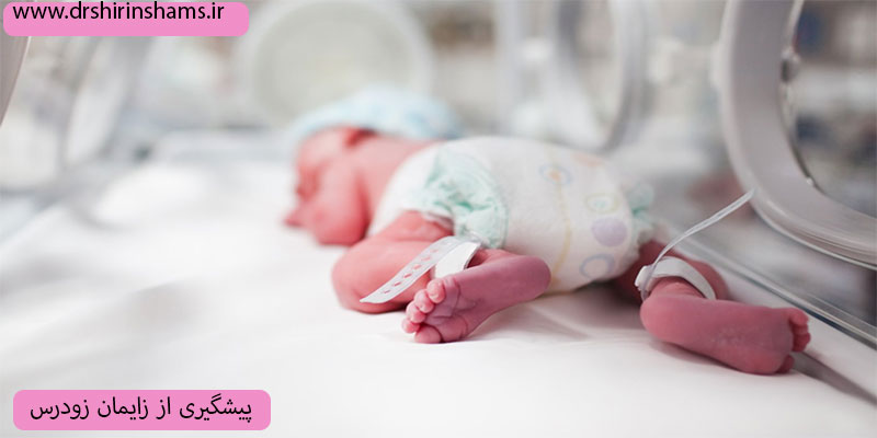 پیشگیری-از-زایمان-زودرس