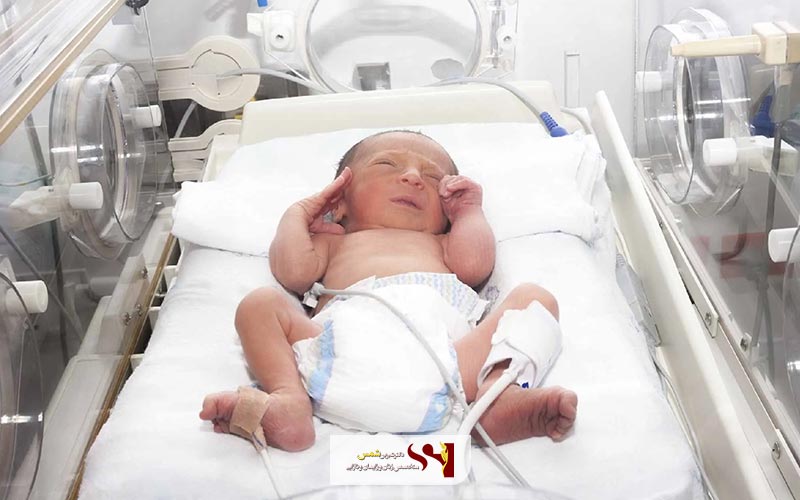 عوارض زایمان زودرس برای مادر و فرزند یا نوزاد چیست