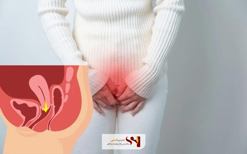 انواع افتادگی رحم یا درجات مختلف افتادگی رحم کدام است؟