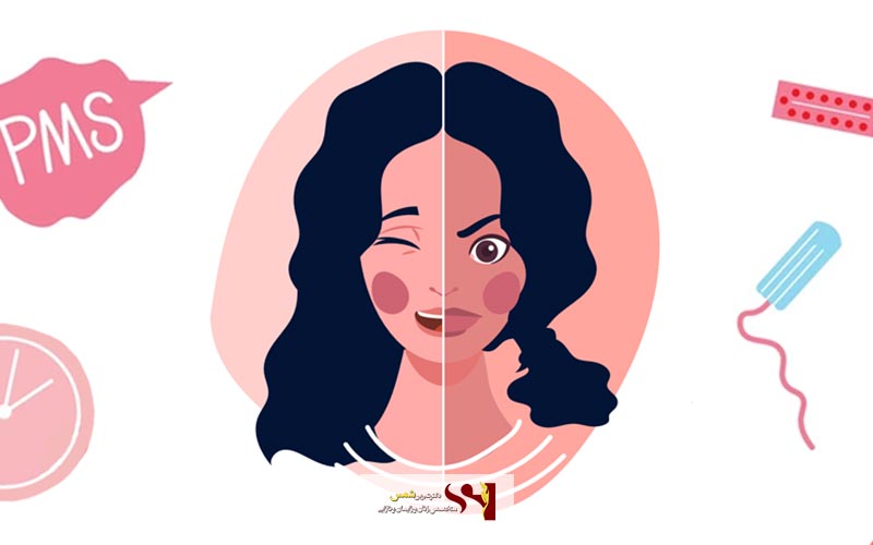 نقش ژنتیک در ایجاد سندروم پی ام اس دختران و زنان