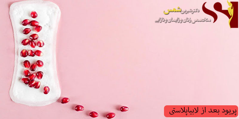 پریود بعد از لابیاپلاستی