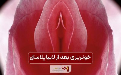 خونریزی بعد از لابیاپلاستی تا چه اندازه طبیعی است؟
