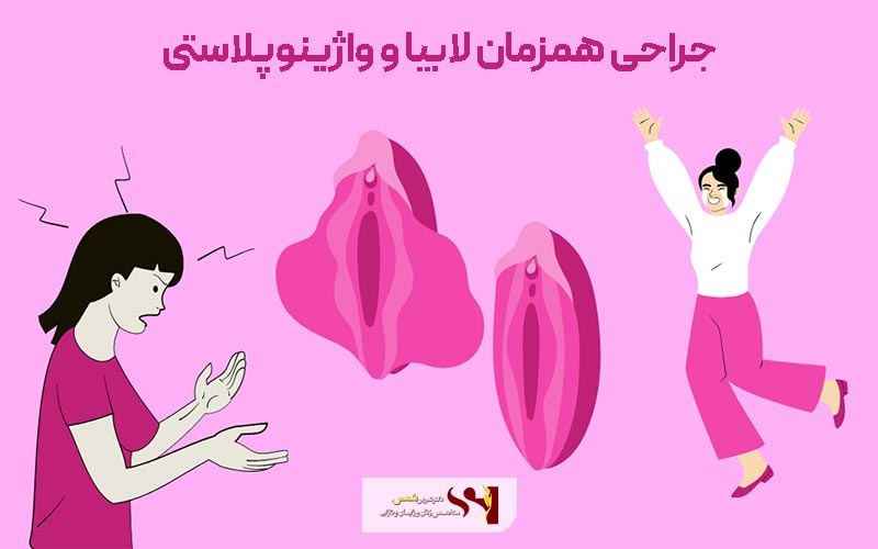 روش های انجام جراحی لابیاپلاستی و تنگ کردن واژن و واژینوپلاستی به صورت همزمان