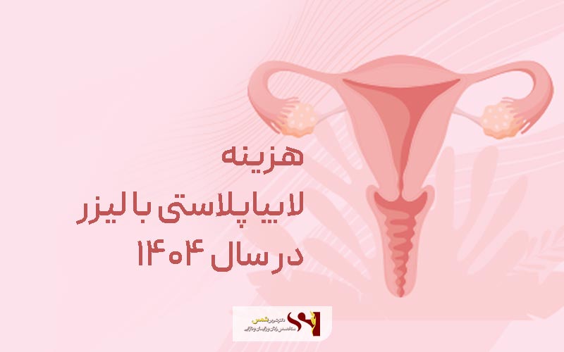 قیمت و هزینه لابیاپلاستی با لیزر در سال ۱۴۰۴