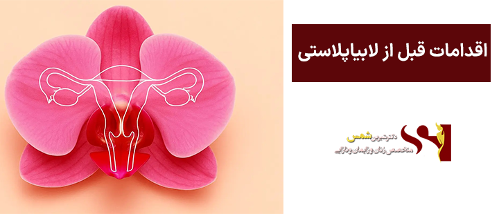 اقدامات قبل از لابیاپلاستی