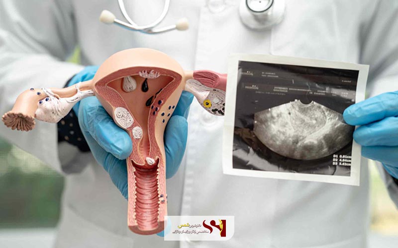 آیا ویروس HPV ارتباطی با نازایی و عدم بارداری دارد؟
