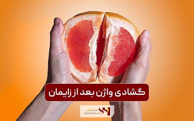 علت گشادی واژن بعد از زایمان