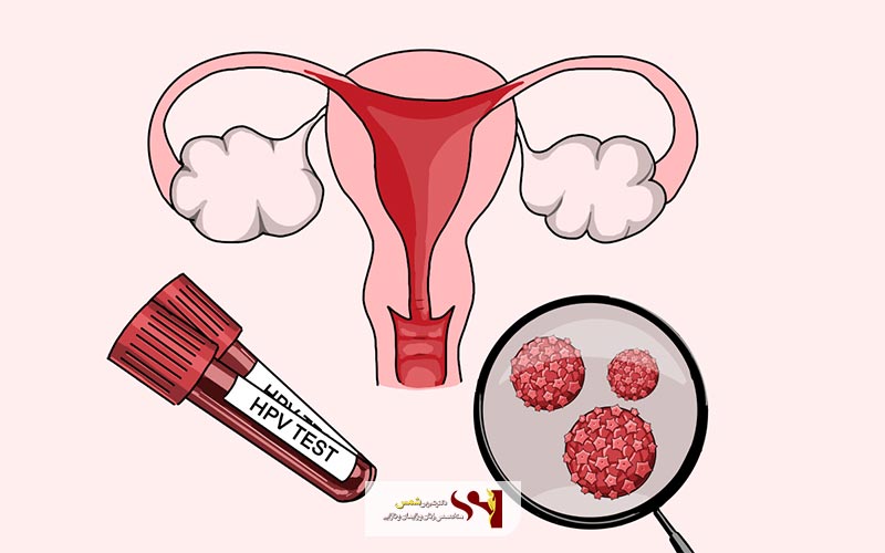 علائم زگیل تناسلی در زنان و مردان چگونه است