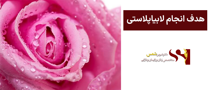هدف انجام لابیاپلاستی